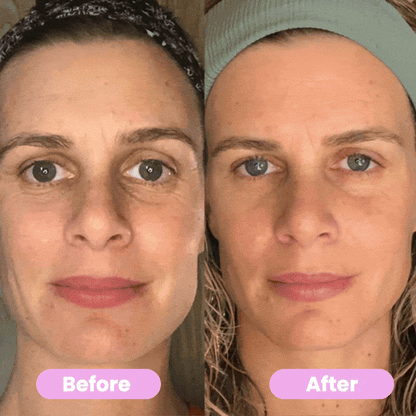LED Face Massager